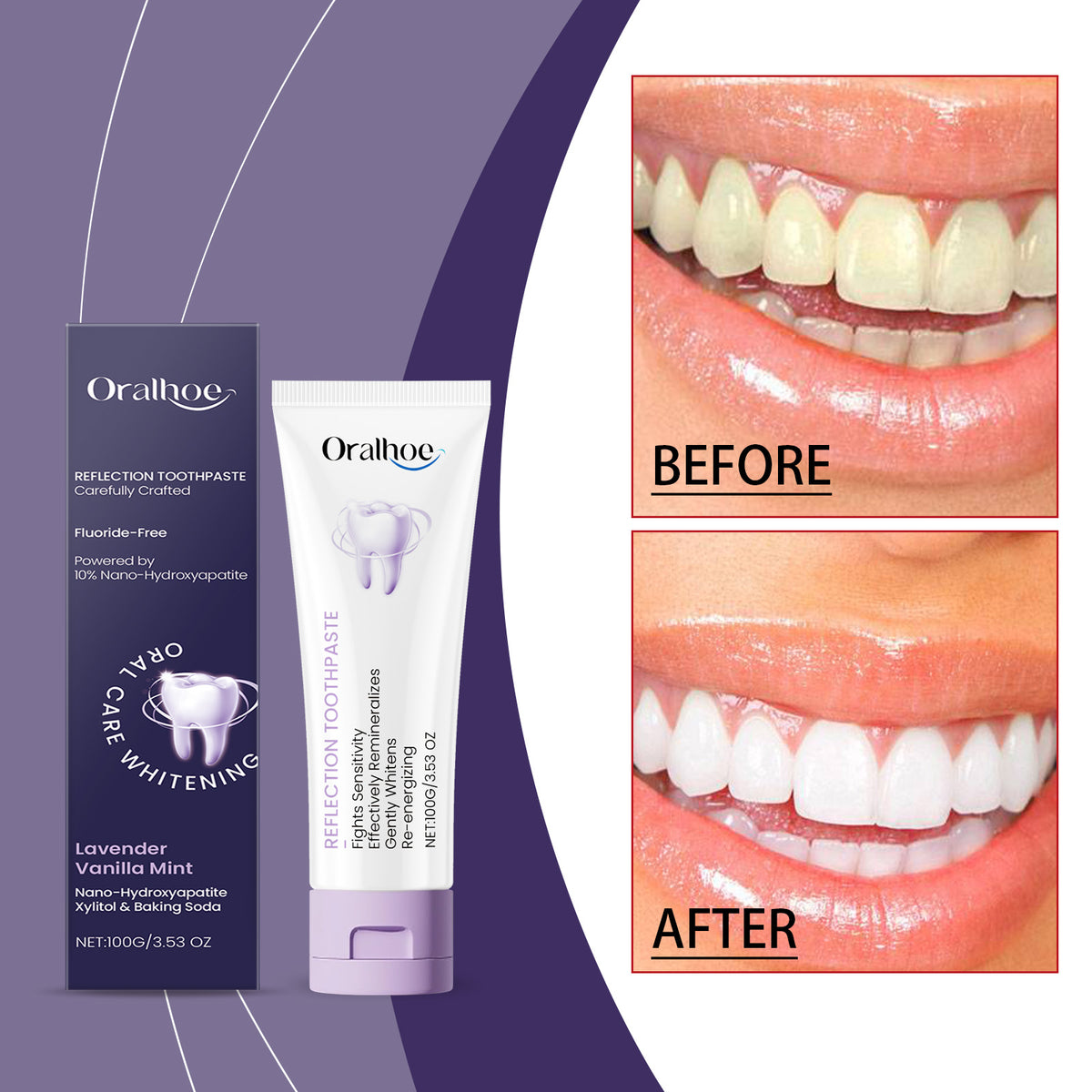 Xylitol Whitening Toothpaste 100g