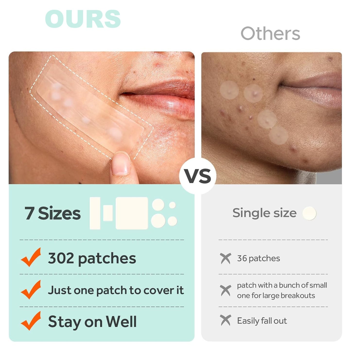 Acne Cover Patch Set 302 Pieces - Clear Skin Pimple Treatment