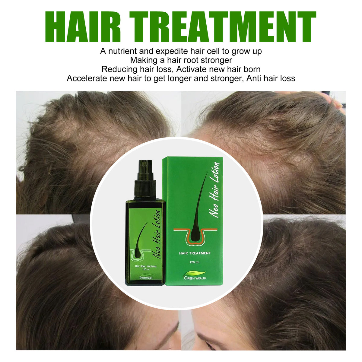 Hair Growth Lotion Spray 120ml