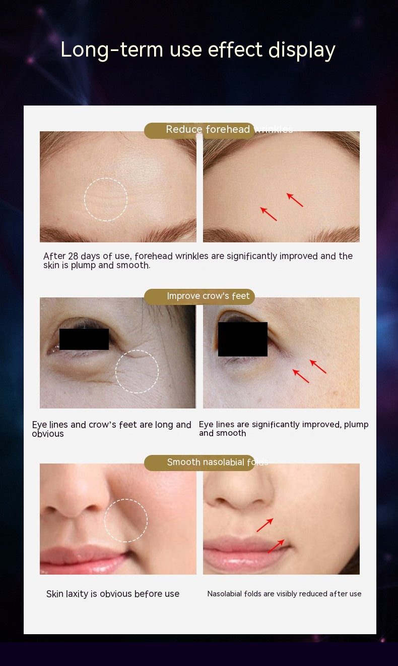 Micro-Current RF IPL Skin Care Device for Face Lifting and Rejuvenation