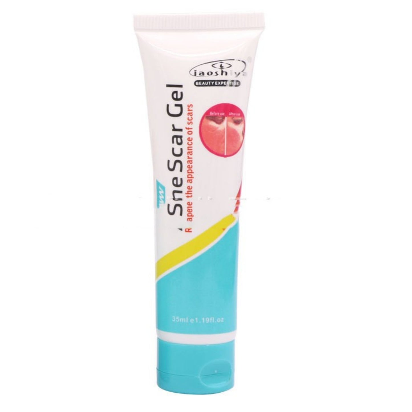Acne Removal Cream with Green Tea & Aloe Vera 35ml - Oil Control & Pore Tightening