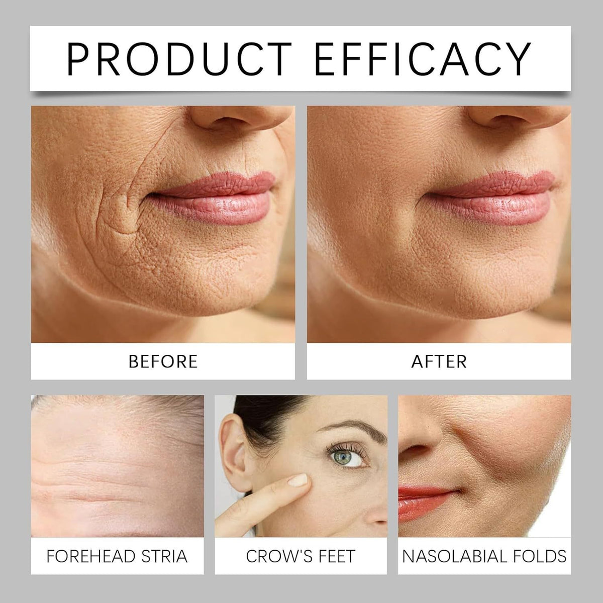 Facial Essence Prevents And Corrects Fine Lines