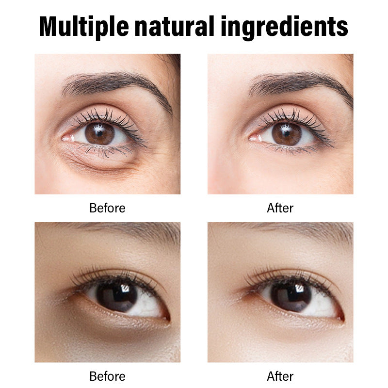 Retinol Eye Cream for Dark Circles - 30g Anti-Aging Facial Care