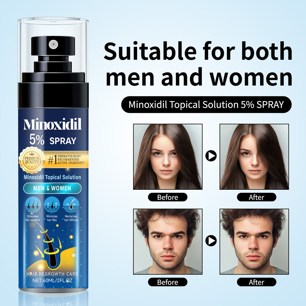 Relieve Hair Thinning And Moisturizing Care Spray