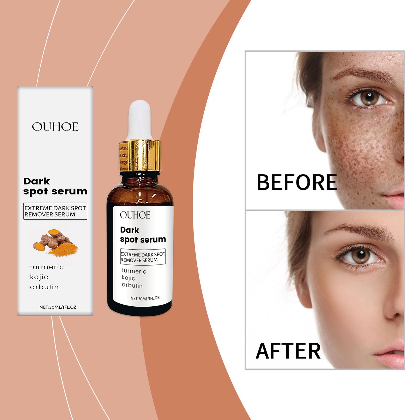 Moisturizing Face Serum with Kojic Acid & Arbutin - 30ml Anti-Aging Essence