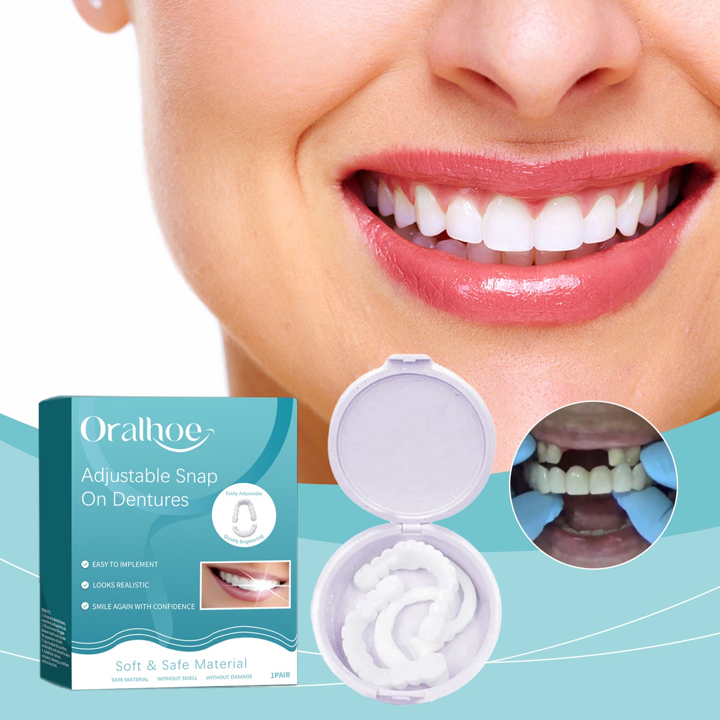 Adjustable Snap-On Silicone Dentures for Natural Smile Correction