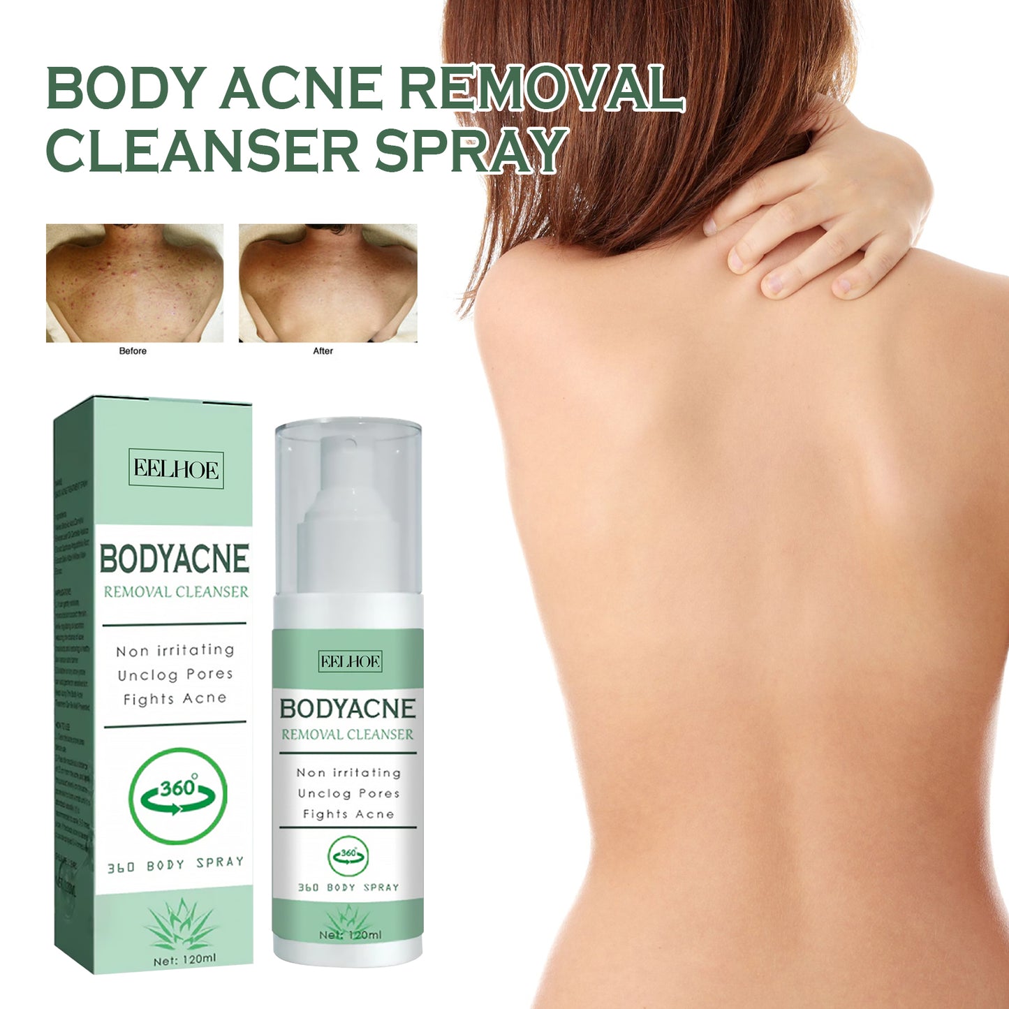 Exfoliating Body Acne Spray - Moisturizing & Skin Clearing Mist 120ml