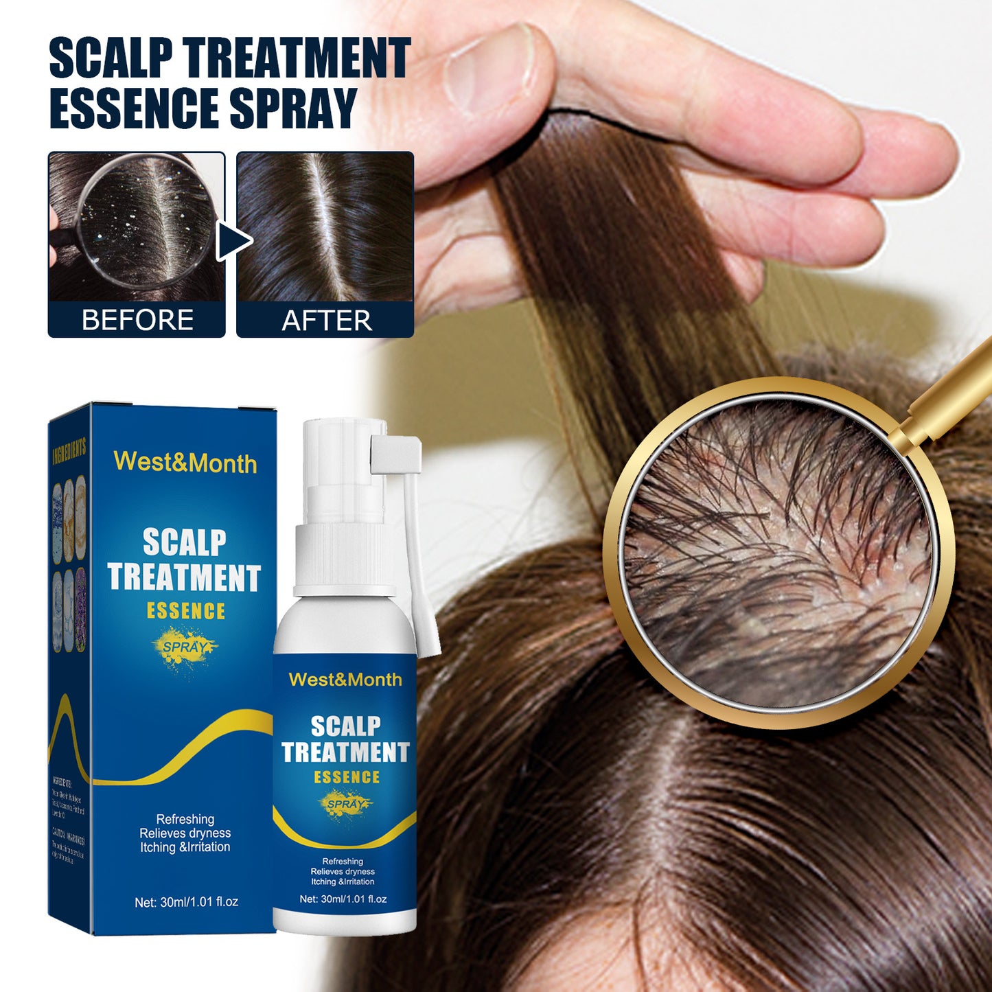 Hair Follicle Damage Repair Spray for Hair Root Care - 30ml