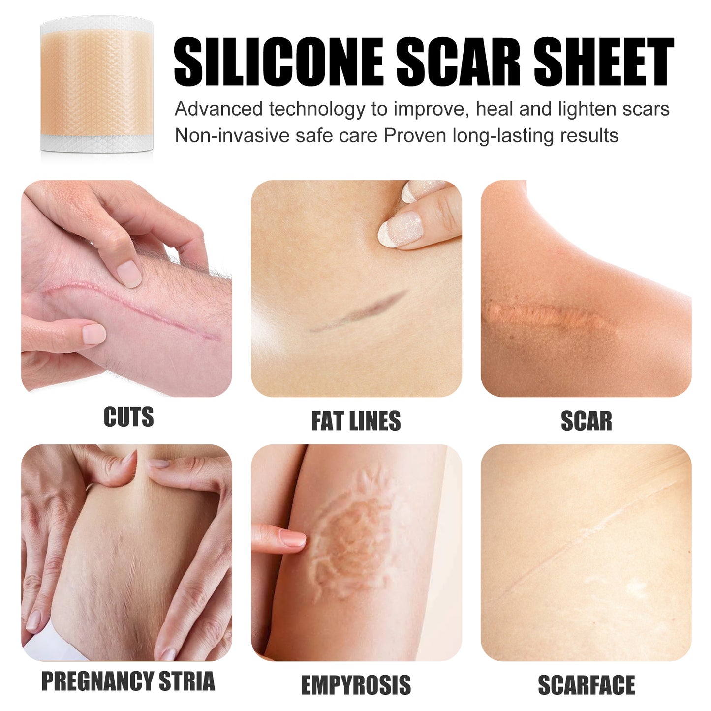 Self-Adhesive Silicone Scar Repair Sheet for Smooth Skin - Cut to Size