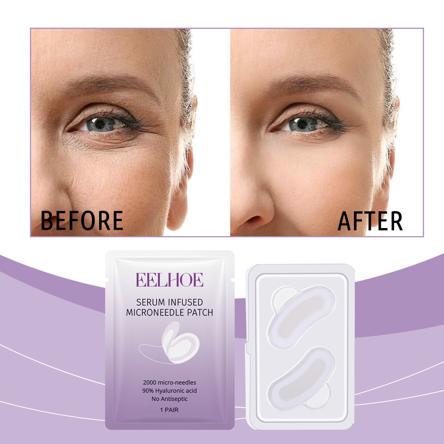 Microneedle Eye Mask Stickers for Skin Tightening & Fine Line Reduction - 1 Pair