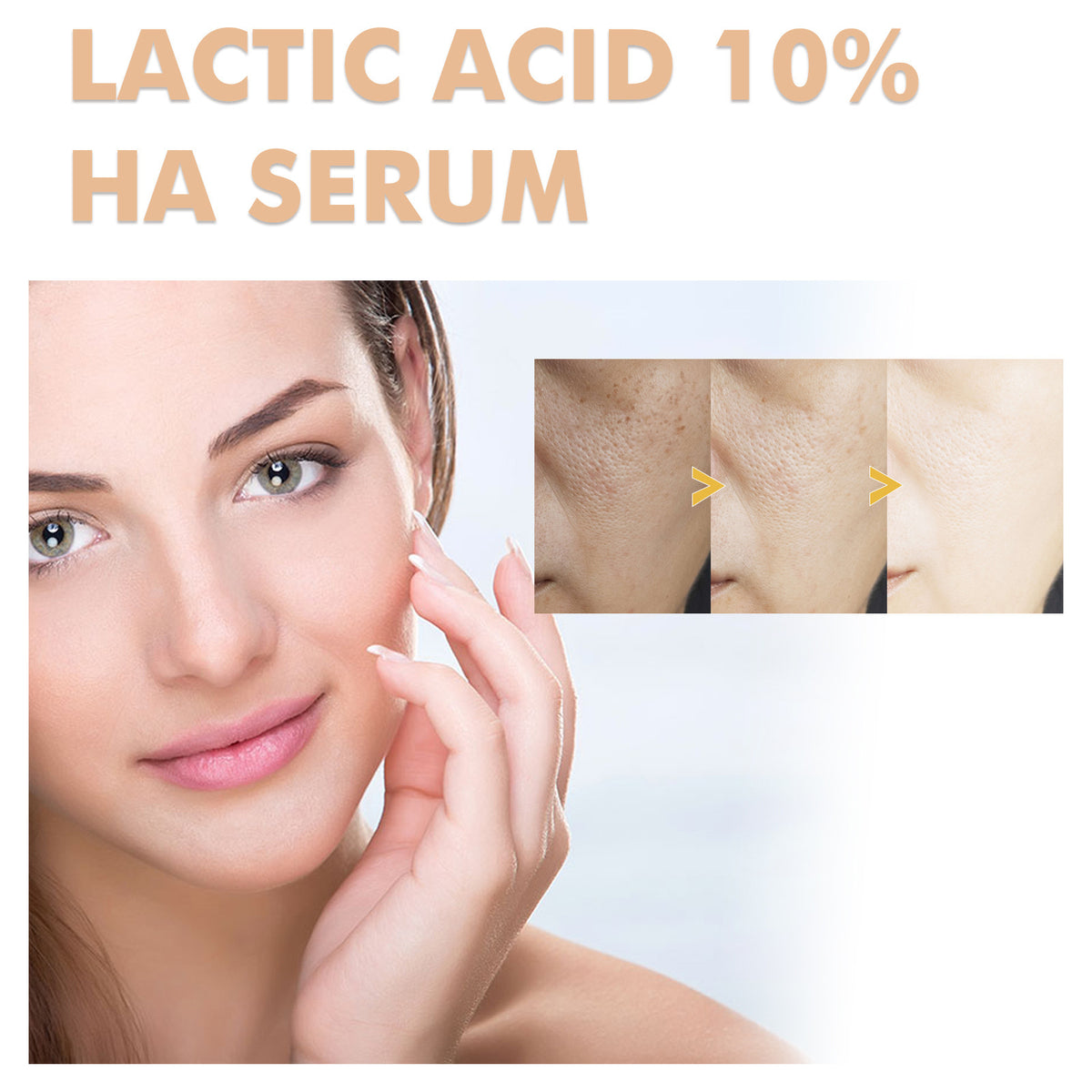 Lactic Acid Facial Essence - 30ml Hydrating & Anti-Acne