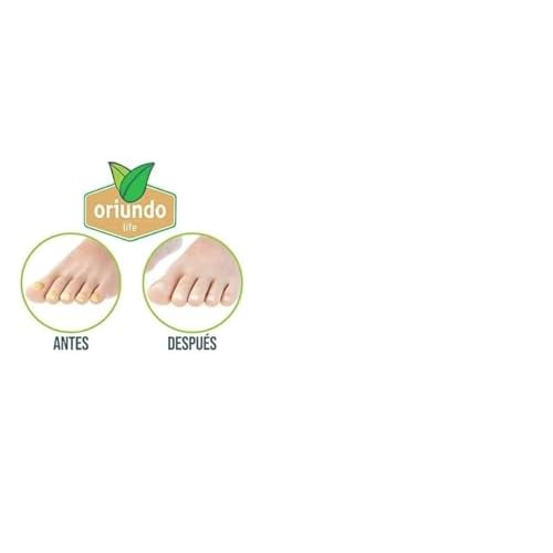 Oriundo Natural Life Nail Treatment Solution, 9 Ingredients, 3 Month Supply