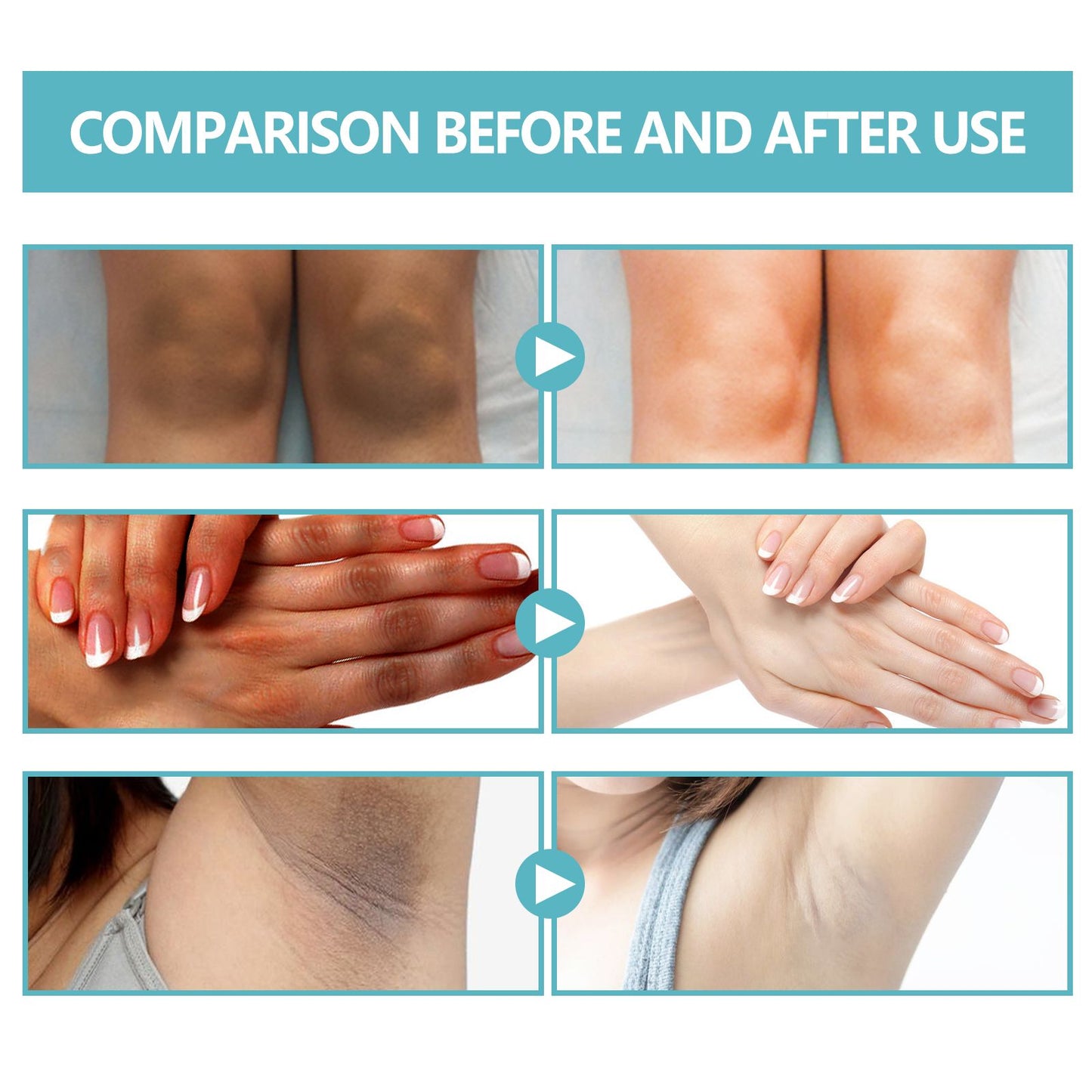 Black Echinacea Dark Spot Repair Cream - Moisturizing & Brightening Body Care