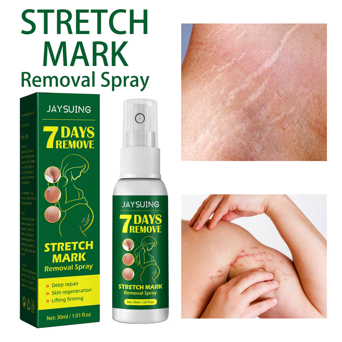 Skin Care Spray Postpartum Firming Fading