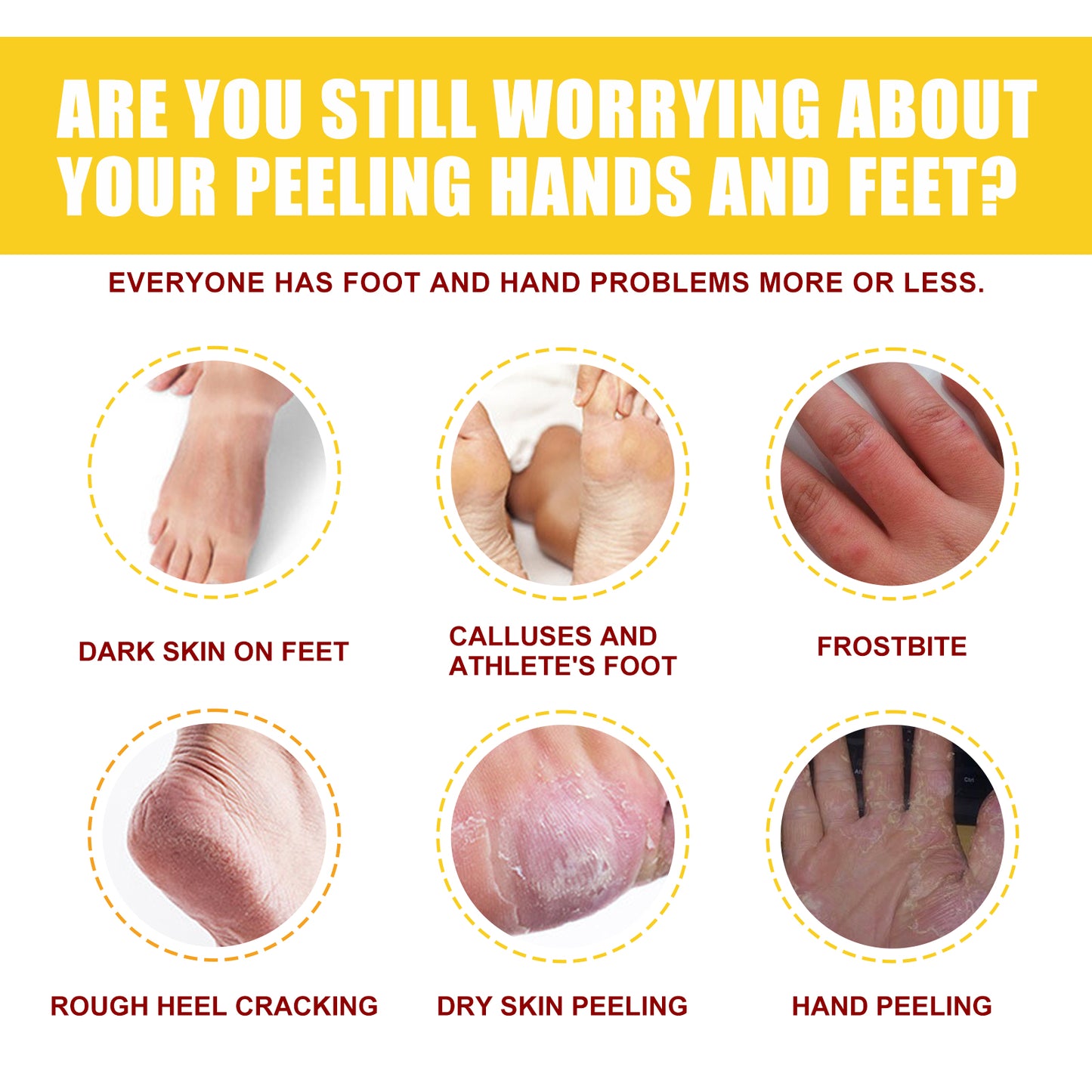 Moisturizing Hand and Foot Repair Cream for Dry Chapped Skin - Multiple Sizes
