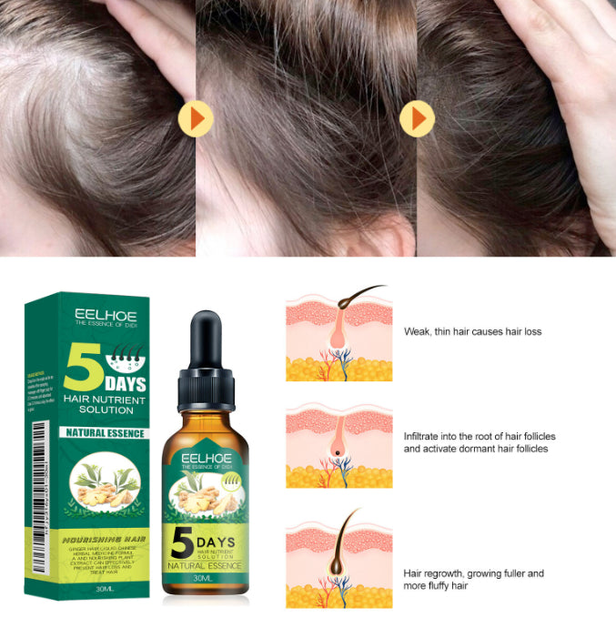 Ginger Hair Care Essential Oil - 30ml