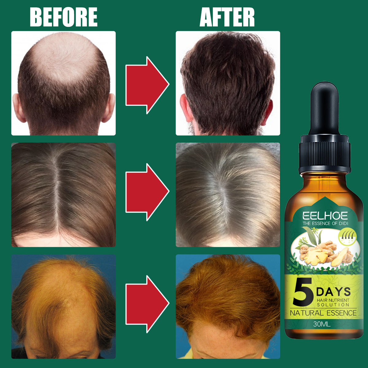 Ginger Hair Care Essential Oil - Moisturizing Nourishing 30ml