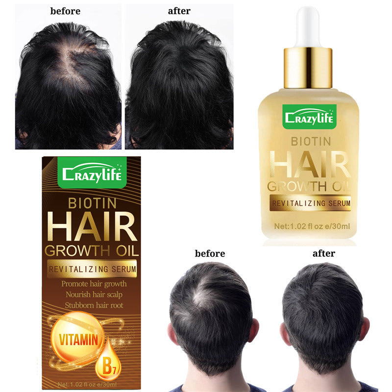 Hair Oil Treatment for Frizz & Split Ends - 30ml