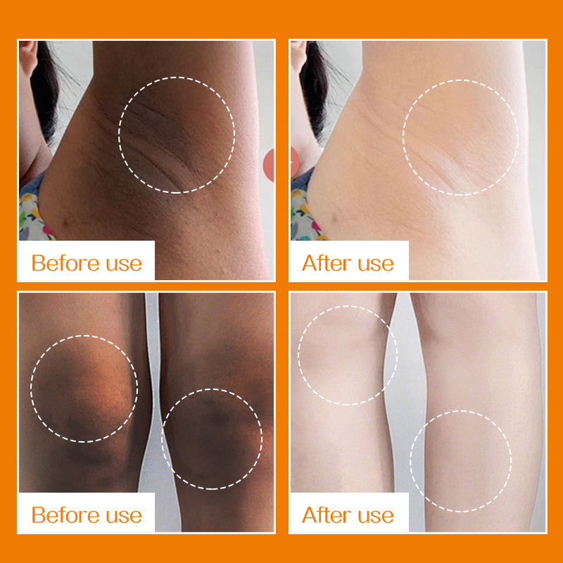 Underarm Whitening Cream 60g - Light Black Tender Skin