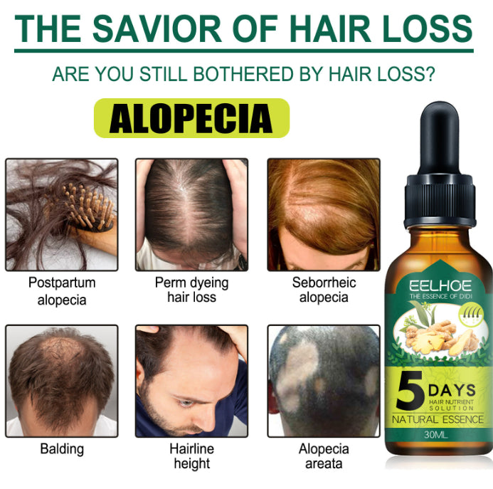 Ginger Hair Care Essential Oil - 30ml