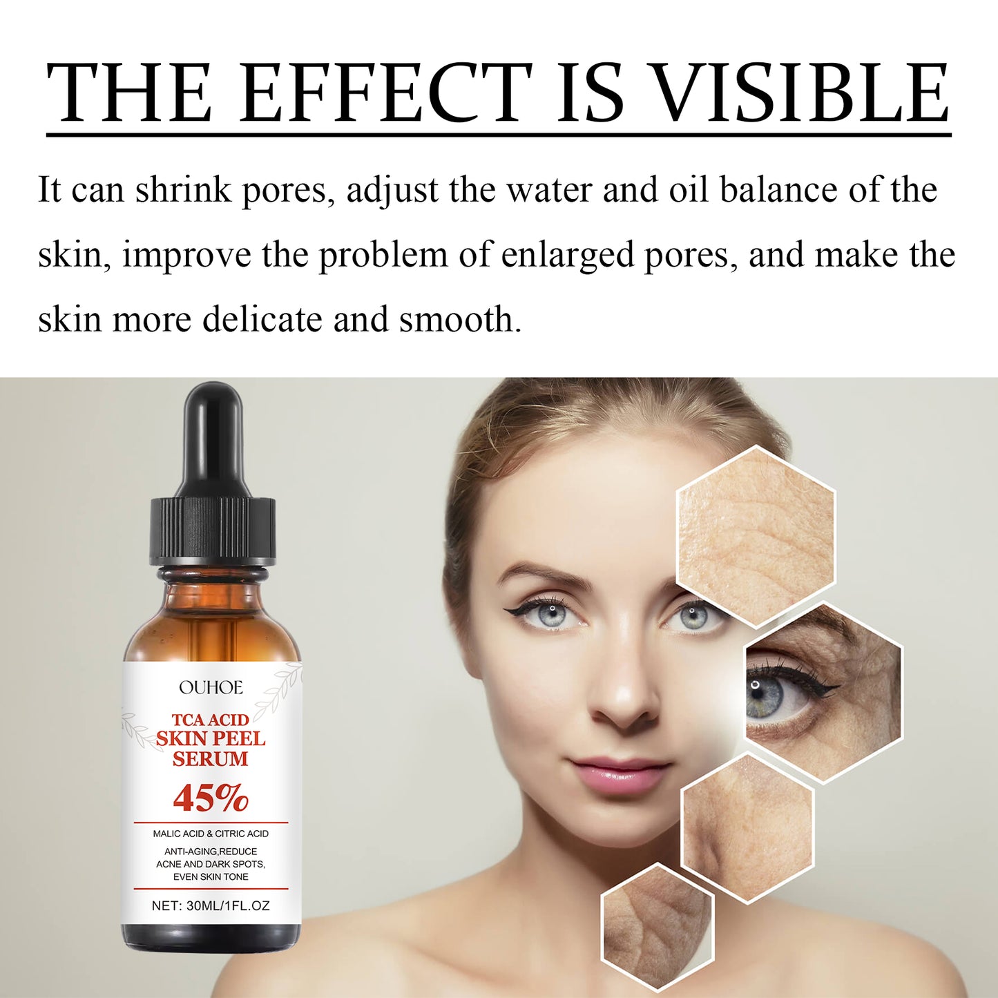 TCA Acid Skin Peel Serum - Anti-Aging Facial Treatment for Smoother Skin