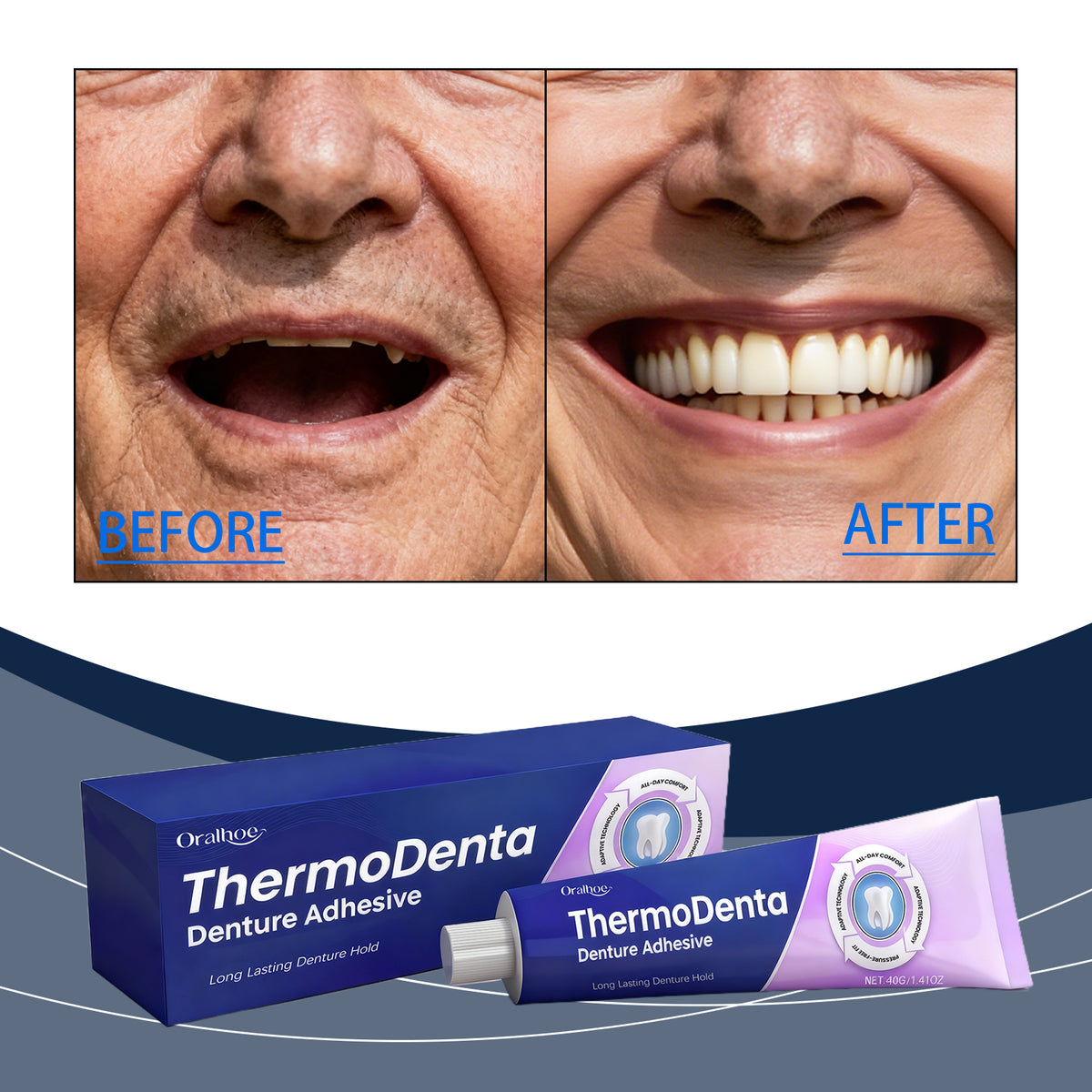 Permanent Denture Adhesive 40g