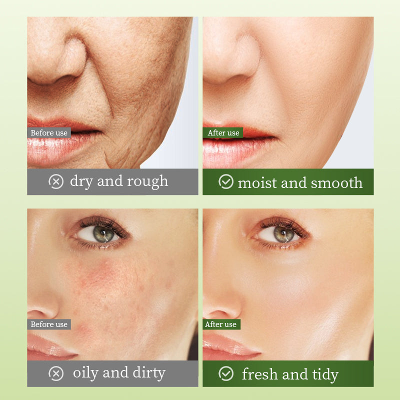 Artemisia Extract Face Mask 55g for Skin Care & Detoxification