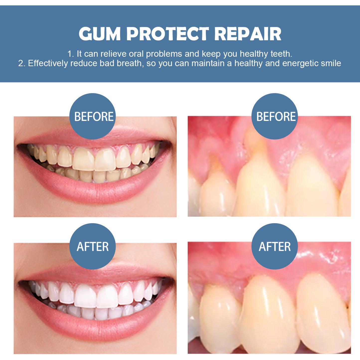 Gum Repair Oral Care Series - Soothing Gel & Toothpaste for Gum Health