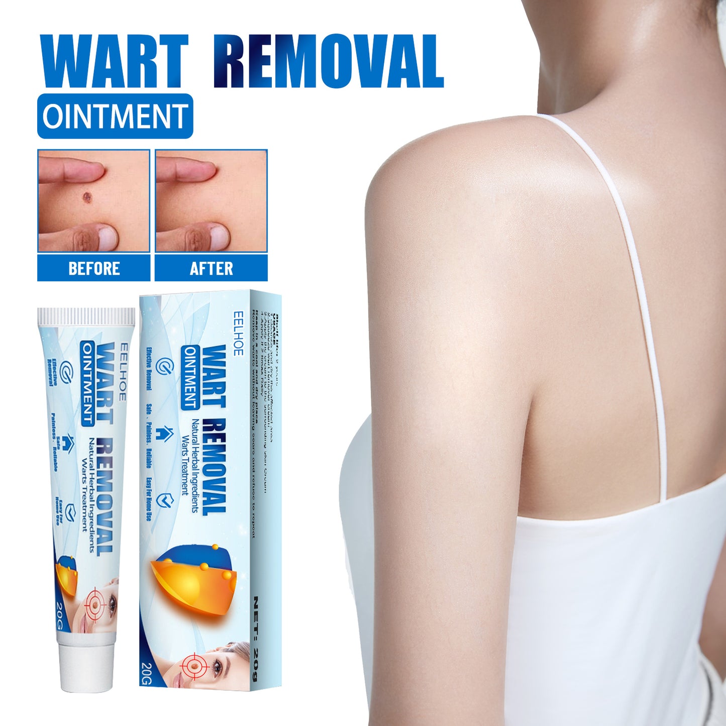 Skin Blemish and Wart Removal Cream - Natural Herbal Formula