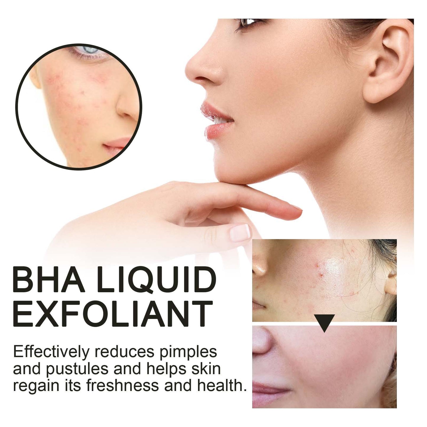 BHA Liquid Exfoliant - Pore-Tightening Facial Essence & Acne Treatment