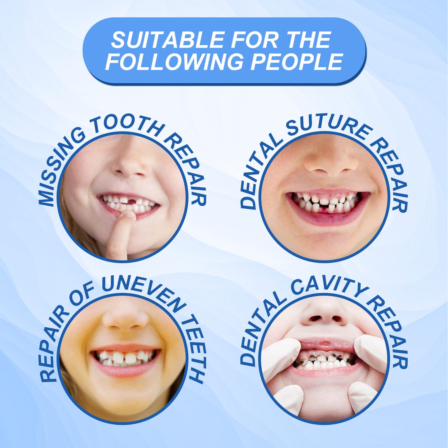 Temporary Tooth Repair Kit - Moldable Dental Filling Gel for Missing Teeth