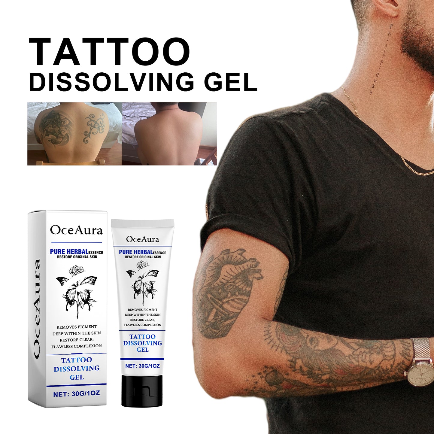 Tattoo Dissolving Gel - Skin Repair & Tattoo Brightening Cream