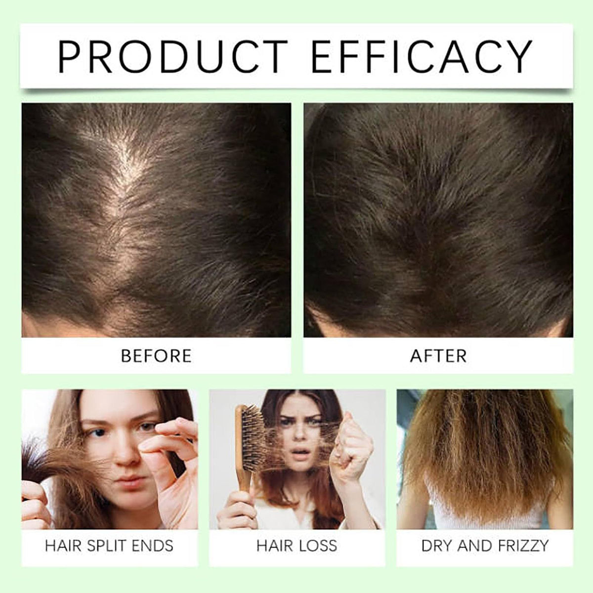 Anti-Hair Loss Shampoo 100ml Moisturizing Hair Growth Treatment