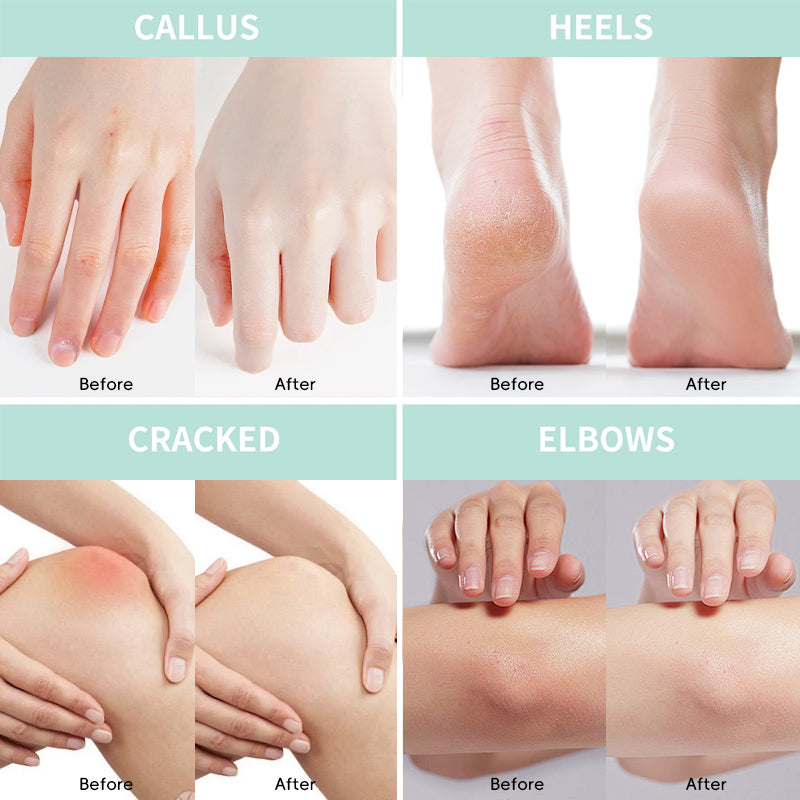 Urea Hand & Foot Cream 150g
