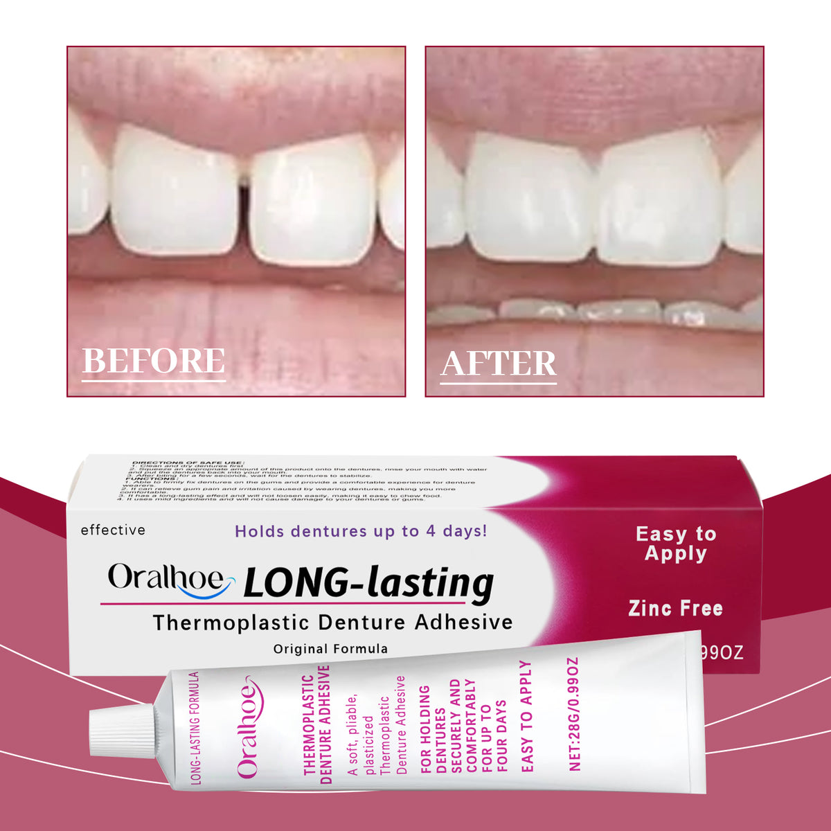 Denture Fixing Adhesive 28g