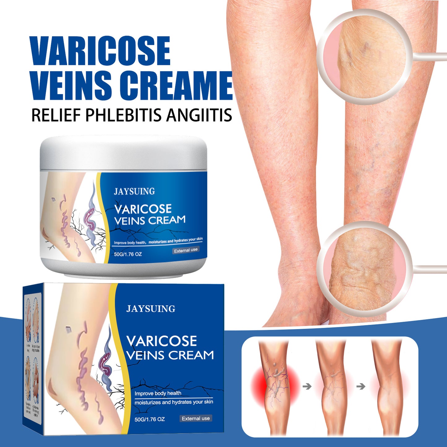 Leg Vein Repair Cream for Varicose Vein Relief and Massage