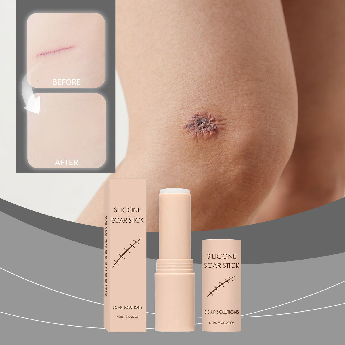 Scar Gentle Care Stick 5.7g