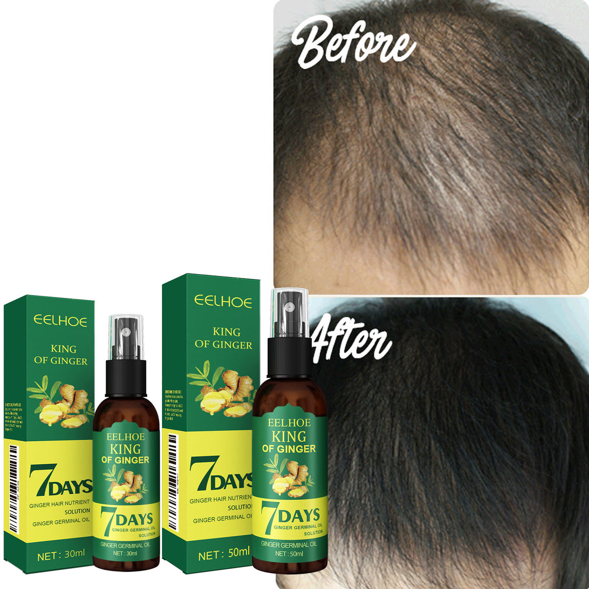 Ginger Strengthening Hair Root Spray 30ml