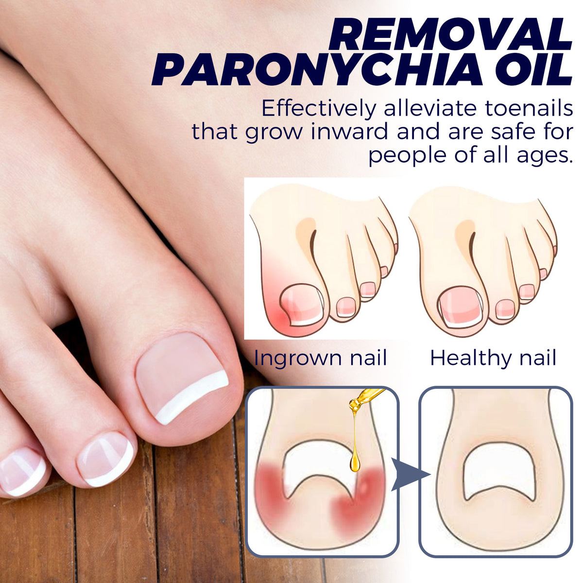 Nail Care Oil 10ml - Toenail & Cuticle Treatment