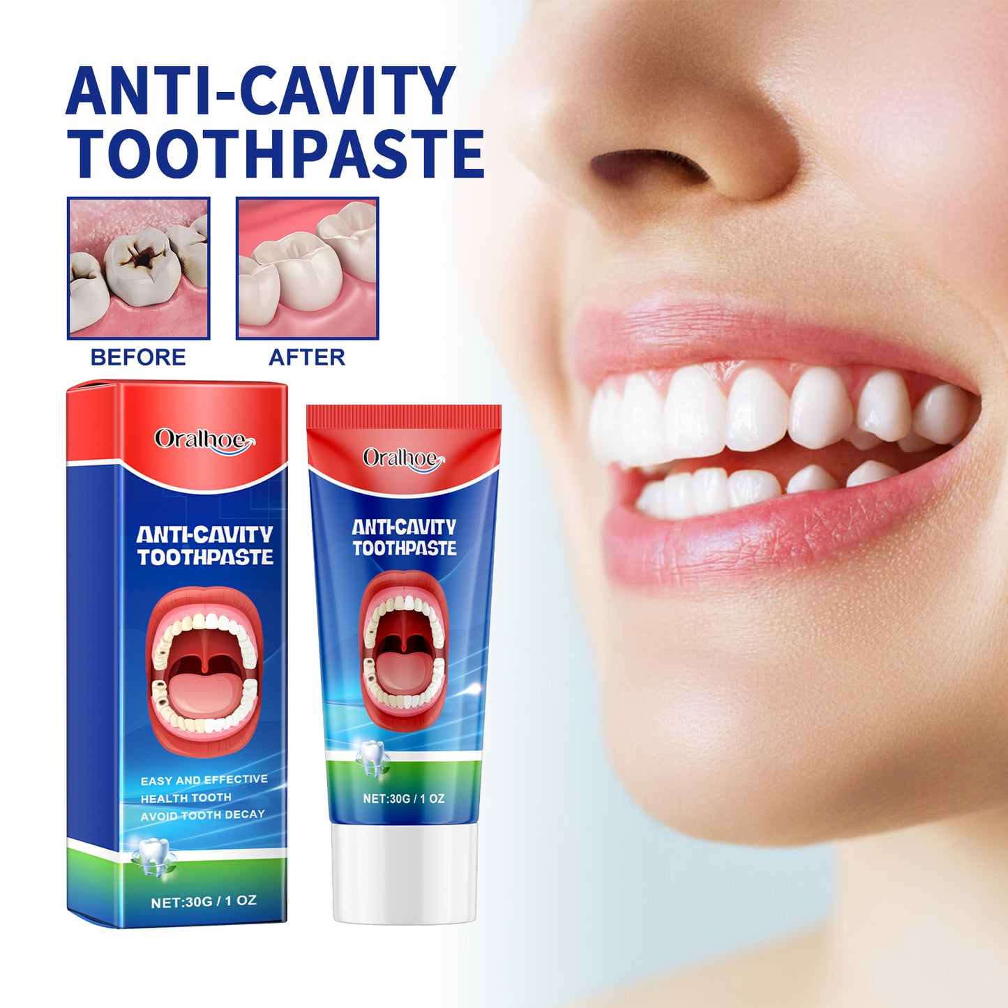 Anti Cavity Toothpaste 30g - Whitens, Repairs & Freshens Breath