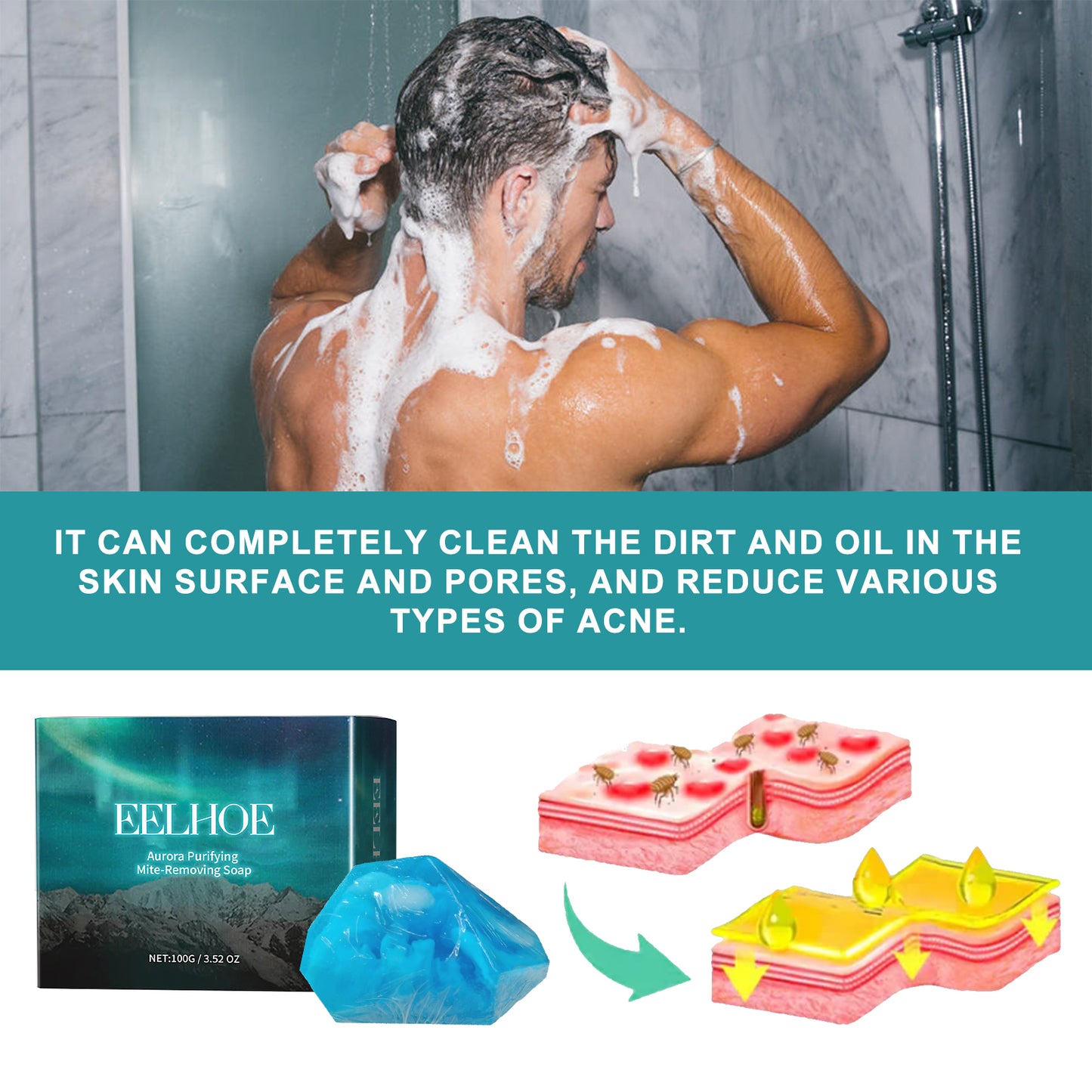 Aurora Purifying Mite-Removing Soap - Deep Cleansing Tea Tree Oil Bar