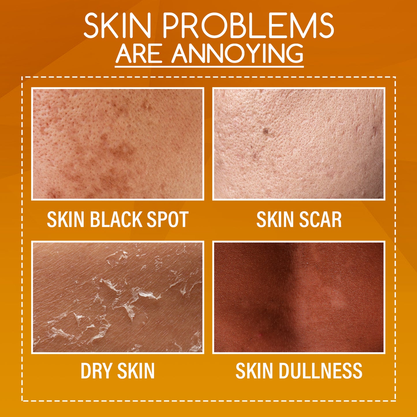 Orange Peel Exfoliating Body Lotion - Brightening & Moisturizing Skin Treatment