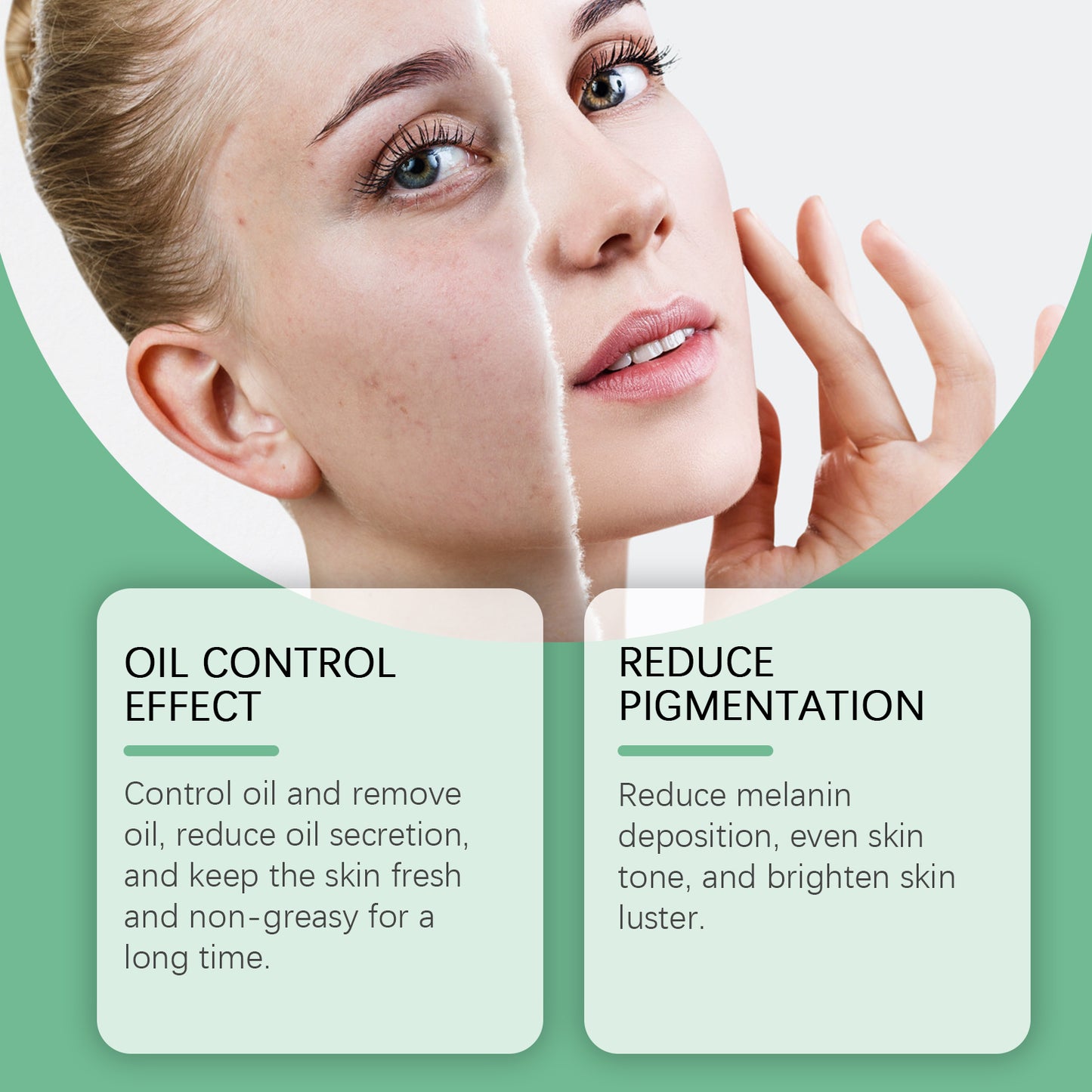 Azelaic Acid Brightening Face Cream - Moisturizing Skin Tone Corrector