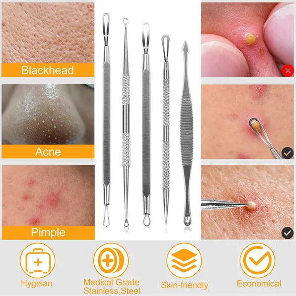 5-Piece Blackhead Remover Kit - Professional Pimple Extractor Tool Set