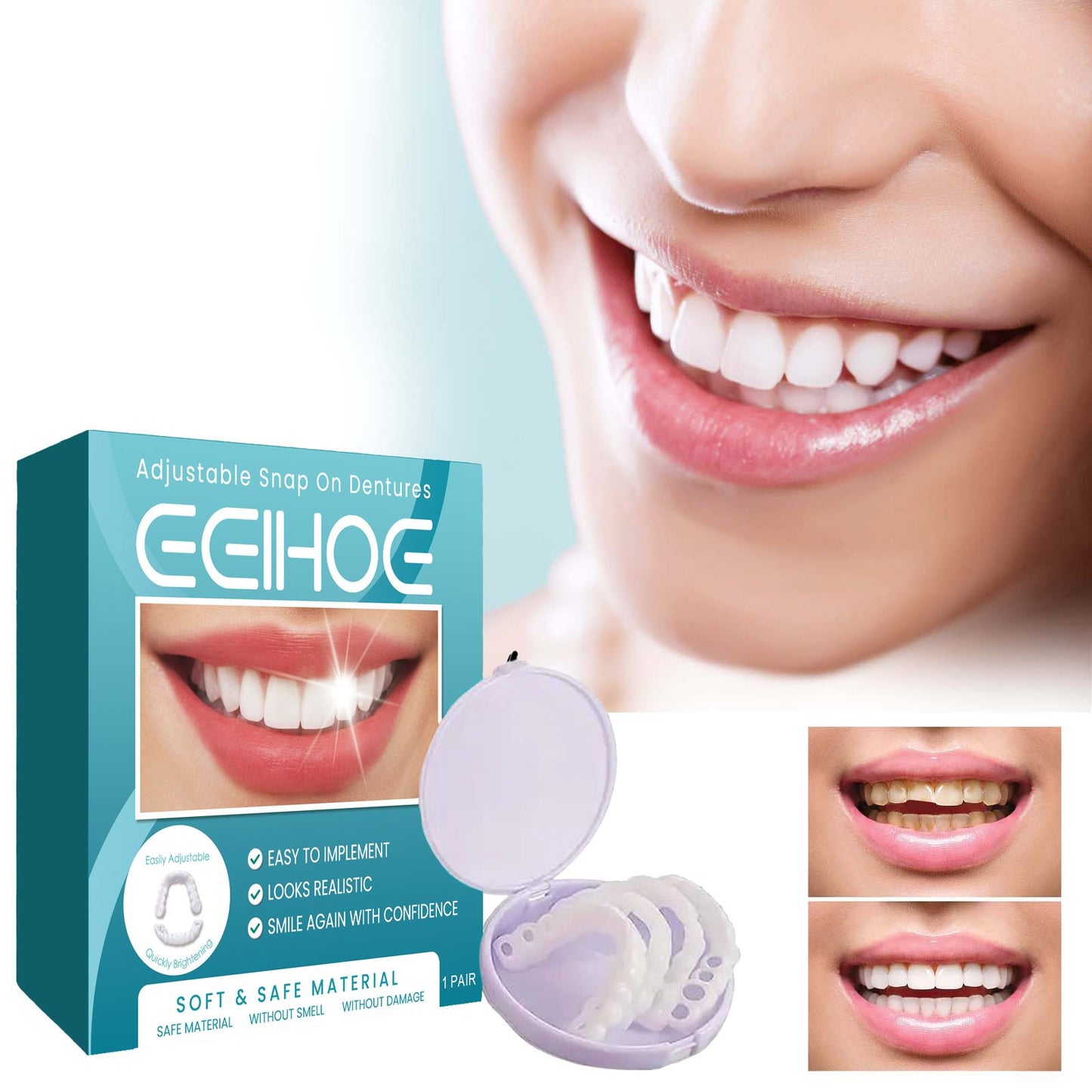 Adjustable Snap-On Dentures - Temporary Gap Filling Dental Kit
