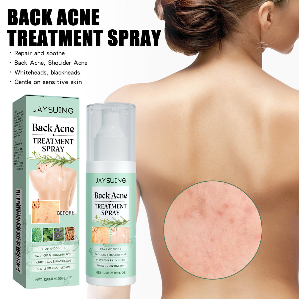 Back Acne Cleansing Spray - 120ml