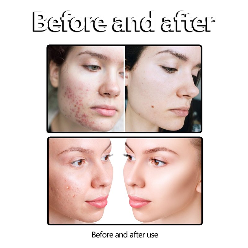 Jasmine Facial Cleanser - 100ml Pore Cleansing Foam