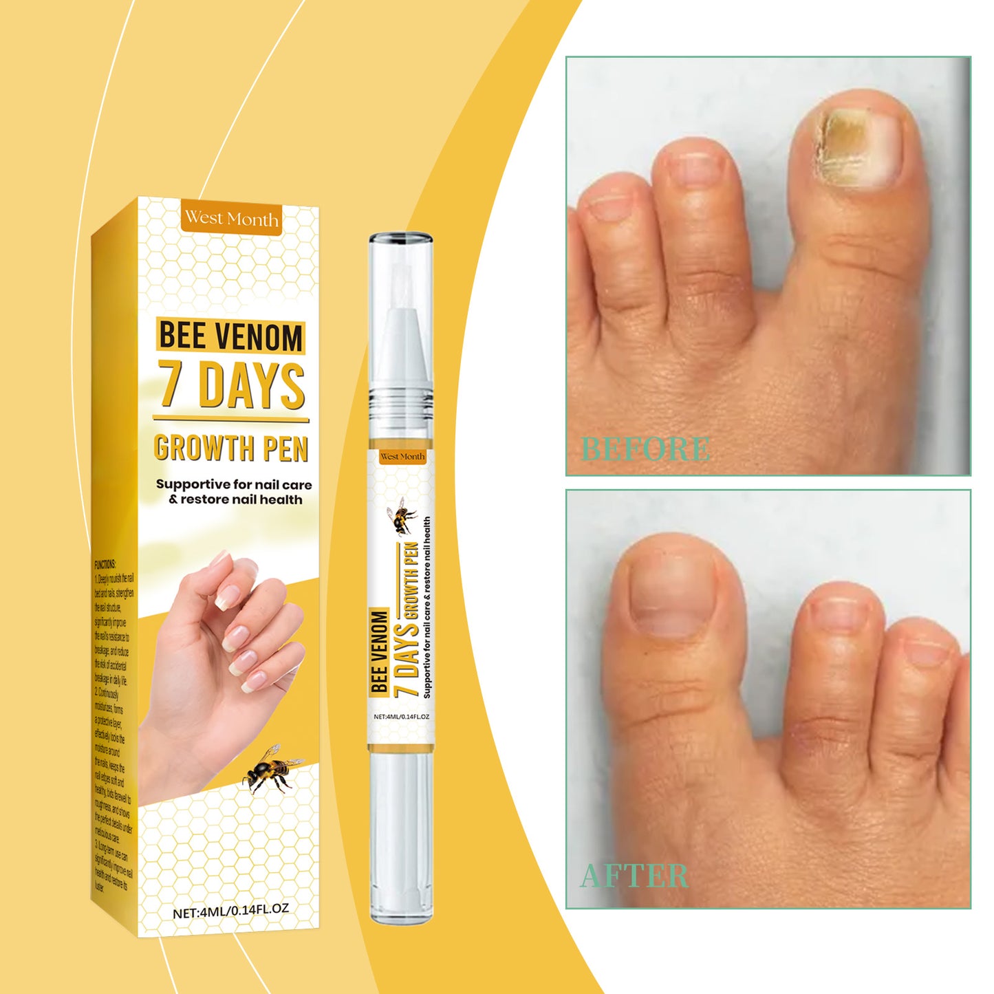 Bee Venom Nail Repair Solution - Moisturizing Hand & Foot Nail Treatment