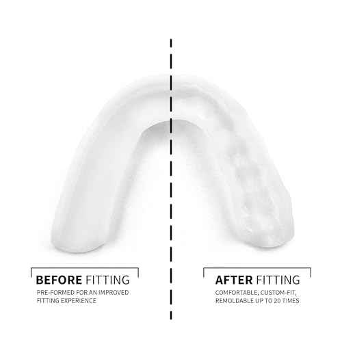 SOVA 3D Night Guard - 2.0mm Thin - Custom-Molded Fit - Protects Against Nighttime Teeth Grinding & Clenching - FSA/HSA Eligible - Odor & Taste Free - Remoldable Up to 20 Times - Non Toxic