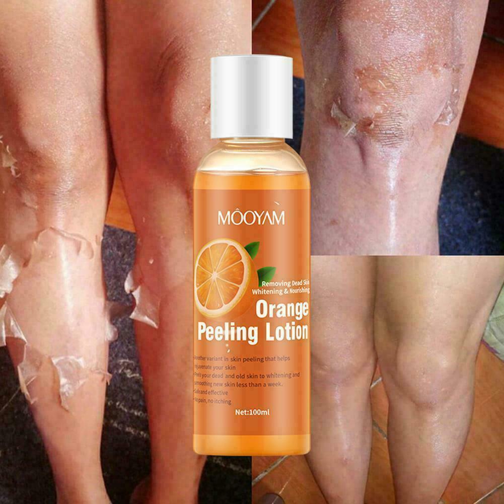 Instant Exfoliating Dead Skin Remover Brightening Gel Hot
